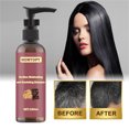 thumbnail image 1 of Teissuly Polygonum Multiflorum Shampoo Herbal Anti-dandruff Anti-itching Hair Nourishing Refreshing Shampoo 100ml Teissuly WER202401271727, 1 of 9