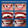 thumbnail image 4 of Kit de Reparación Temporal de Dientes Postizos Eelhoe 10g, 4 of 4