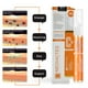 thumbnail image 2 of Crema Blanqueadora Antimanchas, Pigmento, Quitamanchas, Manchas Oscuras, Crema Para Quitar Pecas ANGGREK  Otros, 2 of 8