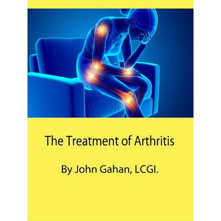 The Treatment of Arthritis - eBook