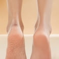 thumbnail image 5 of Rechargeable Foot and Nail Remover with Digital Display, 5 of 5