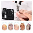 thumbnail image 7 of Toenail Care Tool Kit, 9-Piece Professional Set for Thick & Ingrown Toenails, Nail Clippers for Men & Seniors, 7 of 7
