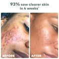 thumbnail image 4 of The Original MakeUp Eraser Cloud Clean Eco Towels XL - 30 Count Dermatologist Tested Wipes, 4 of 12