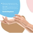 Smith+Nephew CICACARE SelfAdhesive Silicone Gel Sheet for Scar