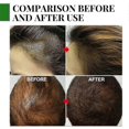 thumbnail image 5 of Rose Mary Oil For Hair Growth Skin Care, Nourishment Scalp, Stimulates Hair Growth, Improves Blood Cir, 5 of 5