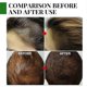 thumbnail image 5 of Rose Mary Oil For Hair Growth Skin Care, Nourishment Scalp, Stimulates Hair Growth, Improves Blood Circulation 30ml -, 5 of 5