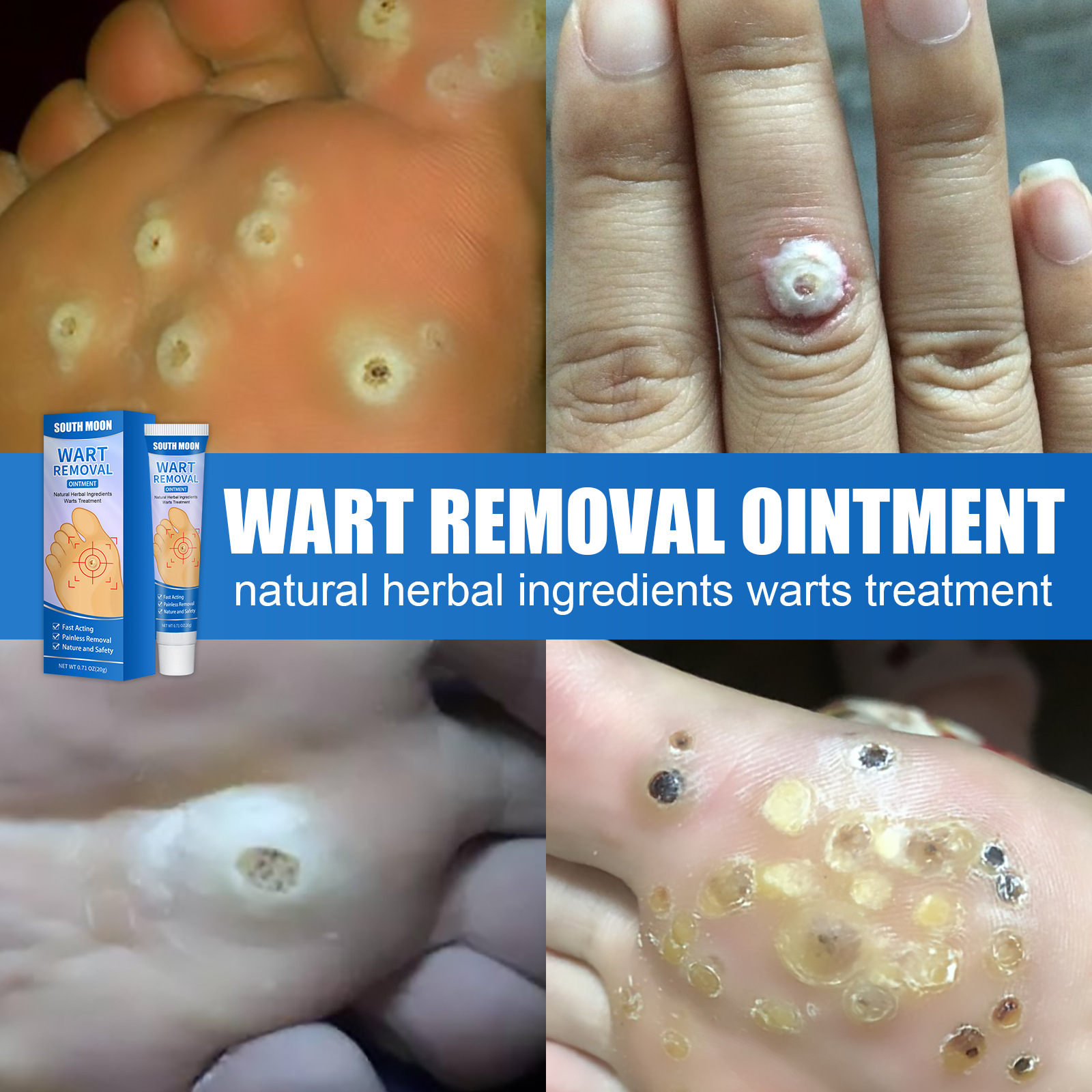 Wart Oil Liquid Drops – Fast, Safe for Kids, Maximum Strength Wart ...