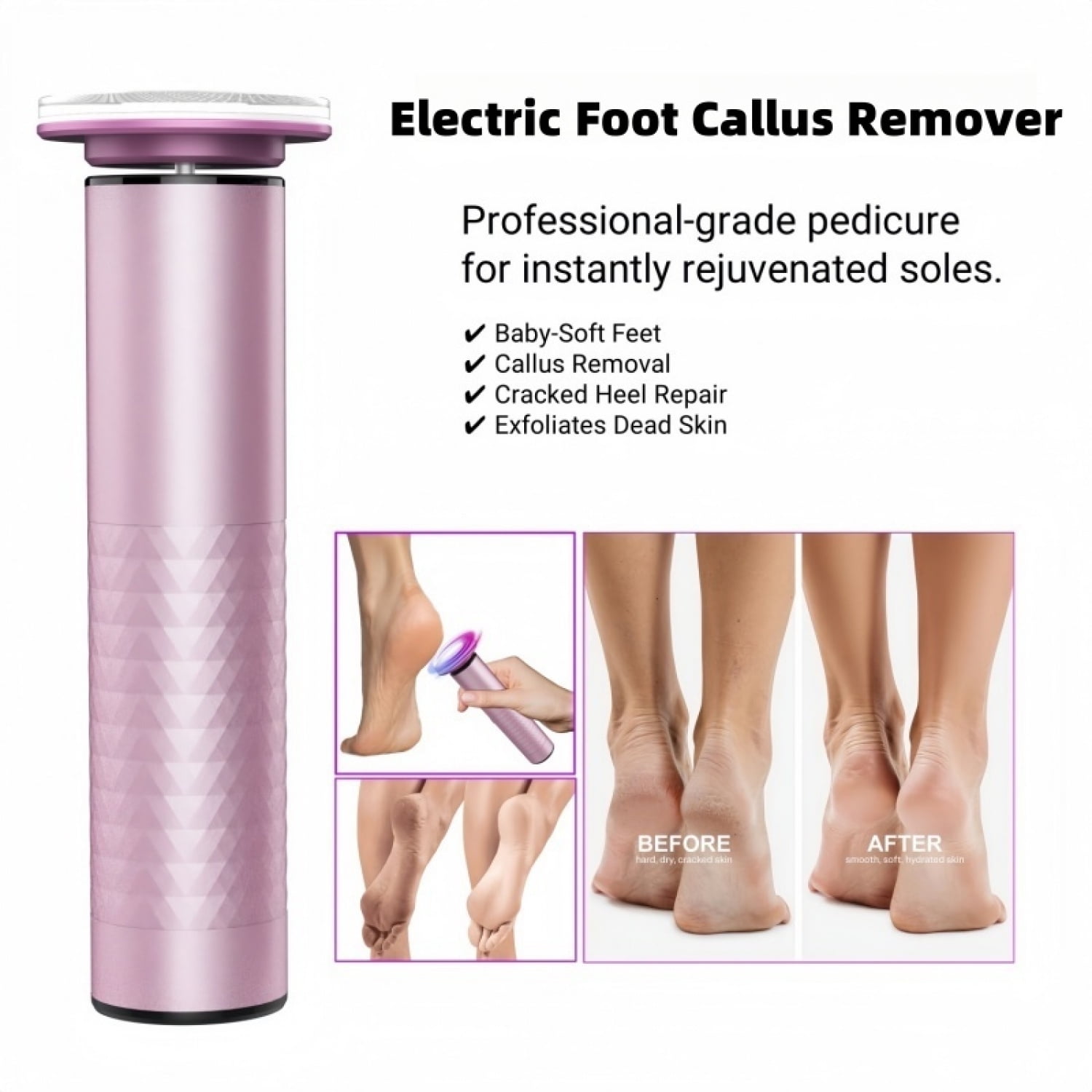 Battery Cordless Corn & Callus Trimmer for Foot