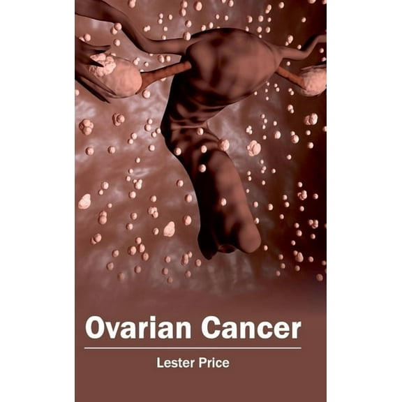 Ovarian Cancer, (Hardcover)