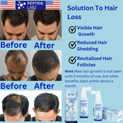 Peptide Hair Growth Serum Spray with Acetyl Tetrapeptide-3, Biotinoyl Tripeptide-1, Caffeine and Licorice Root Extract