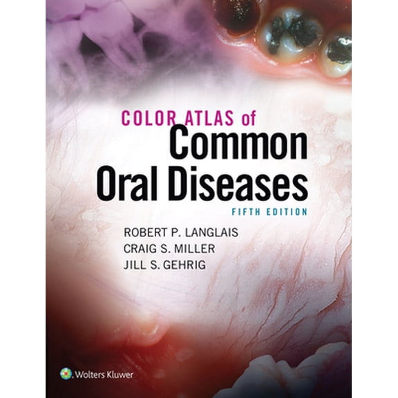 Pre-Owned Color Atlas of Common Oral Diseases (Paperback) 1496332083 9781496332080