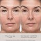 thumbnail image 4 of TheraFace PRO Microcurrent Facial Device - 8-in-1 Compact Face Massager, Facial Kit & Face Sculpting Tool with Light Therapy for Skin Tightening, Anti Wrinkle, Anti Aging & Skin Care (White), 4 of 5