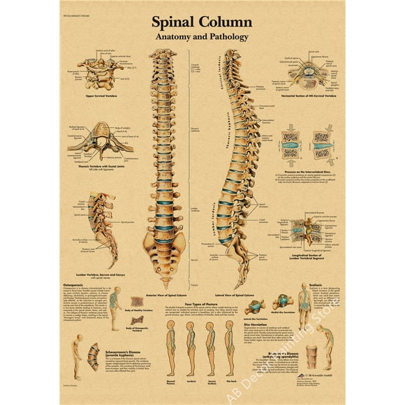 Retro Organ Systems In The Human Body Posters Skeleton Anatomy Kraft Paper Prints DIY Vintage Home Room Art Wall Decor Paintings, 50*70cm, unframed.,24