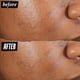 thumbnail image 3 of Pimple Patch Kiehl's Truly Targeted para eliminar el acné, 15 ml, con ácido salicílico, 3 of 8