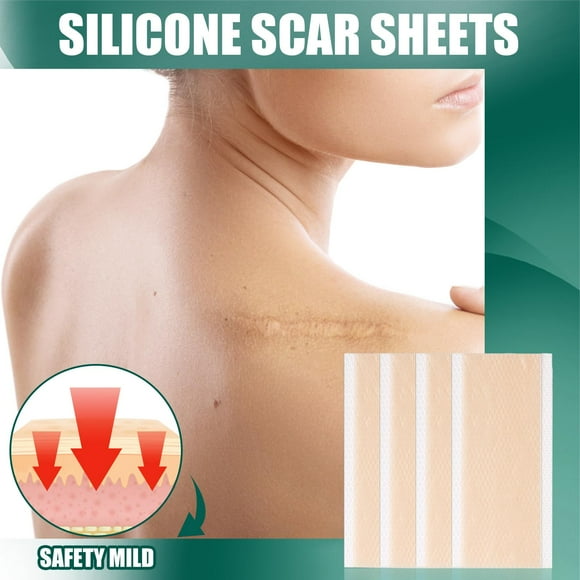 de eliminación de cicatrices de silicona suavizan las cicatrices 15x4cm shamjiam Cintas para cicatrices