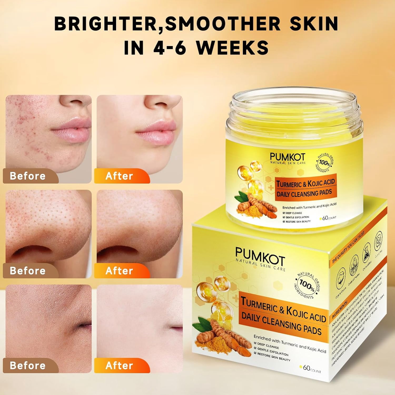 Kojic Acid and Turmeric Cleansing Pads, Turmeric Cleansing Pads, Face Turmeric Kojic Acid Pads, Helps Balance Skin Oil And Water - 60 Pack