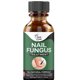 thumbnail image 2 of Anti Fungus Toe Repair Essence Onychomykose Paronychie Nagelpilz Behandlung Ndcxsfigh Cuidado Belleza, 2 of 8