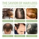 thumbnail image 5 of OUHOE Aceite a base de hierbas para el cabello Nutre suavemente el cuero cabelludo Fortalece la limpieza del cabello Cuidado del cuero cabelludo Aceite para el cabello suave,2 piezas, 5 of 10
