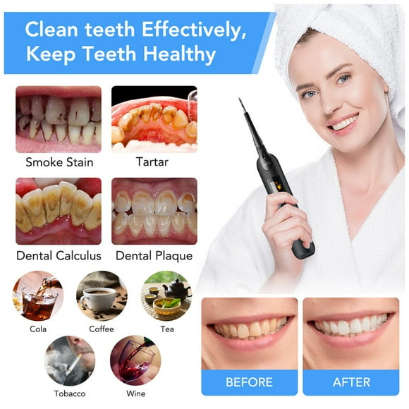 Tooth Whitener Electric Rechargeable Teeth Scaler Adjustable IPX6 Electric Teeth Scaler Rechargeable Scaler Rechargeable Waterproof Tooth Cleaning Whitening Tool