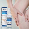 thumbnail image 1 of EELHOE intravenous massage spray relieves pain in veins and leg blood vessels and smoothes earthworm legs Massage Oil1PCS), 1 of 5