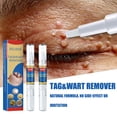 thumbnail image 1 of Removedor de verrugas Skin Tag Pen Professional Papillomas Moles Removal Pen (03) Ndcxsfigh Nuevos Originales, 1 of 9