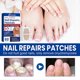 thumbnail image 4 of Multi Purpose Fungal-Nail Renewal Stickers, Strengthens Moisturizes Nail Care Stickers, for Nails Care Supplies, 4 of 5