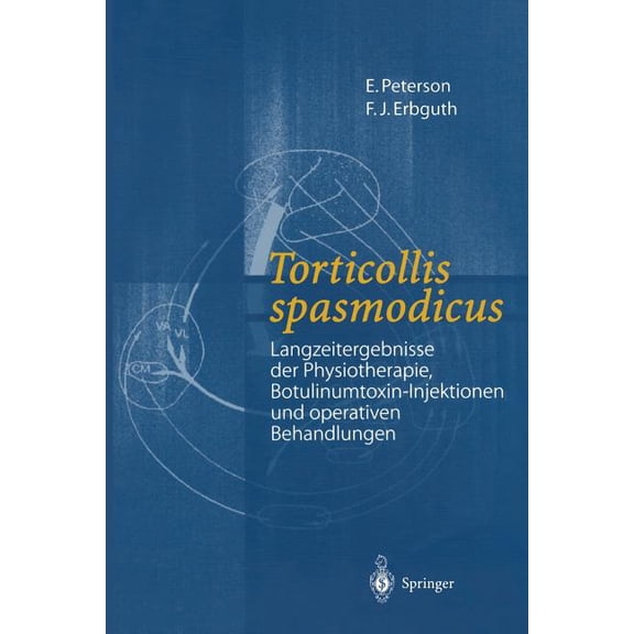 Torticollis Spasmodicus: Langzeitergebnisse Der Physiotherapie, Botulinumtoxin-Injektionen Und Operativen Behandlungen, (Paperback)