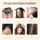 thumbnail image 4 of Ginger Plant Extract Anti-Hair Loss Hair Shampoo -aqwg, 4 of 5
