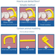 thumbnail image 1 of Hilo dental especial para madres e hijos, bolsa de hilo dental de seguridad, palillo para limpiar los dientes de leche, 1 of 1