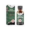 thumbnail image 2 of 2pcs Extra Strength Nail Repair Fluid Toenail And Nail Solution Toenails And Nails Repair Damaged And Discolored Nails new, 2 of 4
