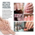 thumbnail image 5 of 3PCS Nail Repair Spray Repair And Clean Nails, Hands, Feet, Soft Nails, Thicken Nails, Polish Nails100ml (PrettyJ), 5 of 5