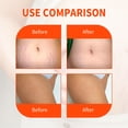 thumbnail image 4 of Aceite Regenerador De La Piel, 4 of 7