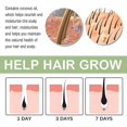 thumbnail image 3 of OUHOE Hair Loss Oil Firms Hair, Prevents Hair Loss, Strengthens Hair, Cleans Scalp, Repairs Smoothness, Hair L, 3 of 4