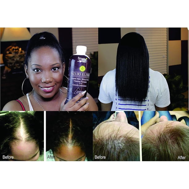 Nzuri Hair Vitamin 32oz | Health ranges for grocery retail