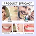 thumbnail image 3 of 1-3PCS Instants Smile Cloves Oil Oral Care Spray,Oral Spray for Long Lasting-Freshness,Portable Breath Freshener Spray for Women Men 2025, 3 of 5