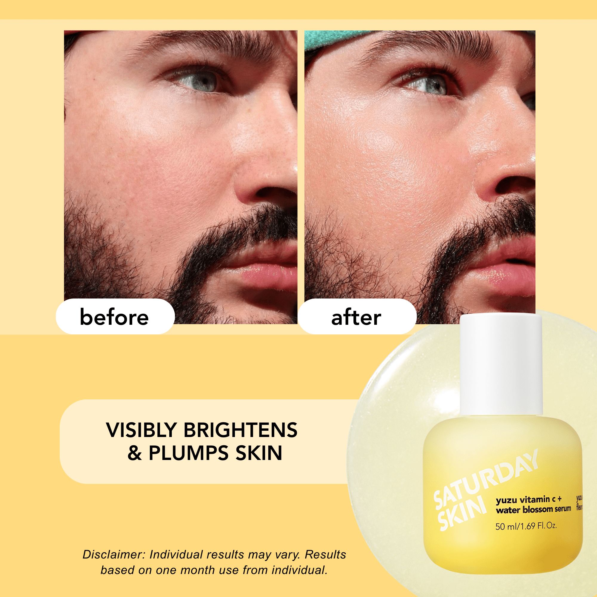 Vitamin C Serum For Face From Yuzu - Brightening Formula With Hyaluronic Acid 7 Peptide Mix And Niacinamide, Deeply Hydrate, Improve Uneven Skin Texture, Vegan, Korean Skin Care (50 ml)