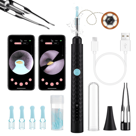Visual Ear Wax Remover Tool with 1080P HD Otoscope, Ear Cleaning Kit, Dual-Purpose Ear Spoons + Tweezers, Washable Silicone Covers, for Kids Adults Pets