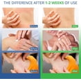 thumbnail image 6 of Hermon Jock Itch Cream: Ringworm Treatment for Humans, Athlete's Foot Cream -Fast and Effective Symptom Relief of Itching, Burning and Redness -100ml, 6 of 10