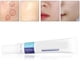 thumbnail image 4 of Acne Cream, Acne Removal Cream Water Oil Balance Moisturizing  For Removing Acne ANGGREK Acne Cream, 4 of 8
