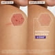 thumbnail image 5 of ADERMA Epitheliale Ultra Repair Crema Reparadora Antimarcas con Avena Rhealba®, Reduce Marcas Visibles, Piel Dañada, 40 ml, 5 of 6