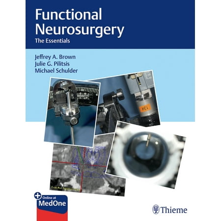 UPC: 9781626237742 | Functional Neurosurgery: The Essentials (Hardcover)