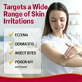 thumbnail image 5 of Hydrocortisone Cream 1% with Soothing Aloe (2 Fl Oz) Fast-Acting Maximum Strength Anti-Itch Relief for Eczema, Psoriasis, Rashes, Hives, Bug Bites & Irritated Skin, Dye Free, 5 of 9