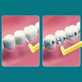 thumbnail image 4 of 20Pcs L Type Angled Interdental Brcomh Brcomh For Braces Micro Soft Brcomh For Dental Brackets Cleaning Short Handle Brcomhes, 4 of 6