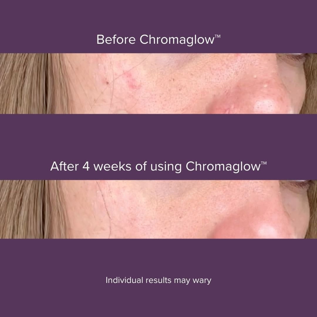 Luyors Chromaglow 7-Color LED Skincare Wand, Anti-Aging Facial Tool, Heat & Red Light Therapy for Dark Circles, Redness & Uneven Tone