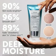 KP Bump Eraser Lotion Keratosis Pilaris Lotion with Glycolic Acid, AHA & BHA Exfoliating Rough & Bumpy Skin Body Lotion