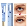 thumbnail image 6 of Eye Balm Cream To Dilute Eye Bags To Fine Lines Moisturize And Tighten The Eyes, 6 of 7