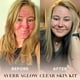 thumbnail image 4 of Kit de Cuidado Facial Averr Aglow Natural, Tratamiento de Acné para Control de Imperfecciones y Redu, 4 of 9