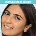thumbnail image 3 of Skin Secrets Spot Patch - Árbol de té y salicílico de Nykaa Naturals para mujeres - Mascarilla de 0,67 oz, 3 of 9
