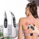 thumbnail image 1 of Bolígrafo de acupuntura recargable, masajeador láser de 5 cabezales, bolígrafo para meridianos de energía para cuerpo, cara, cuello, 1 Uds., 1 of 5