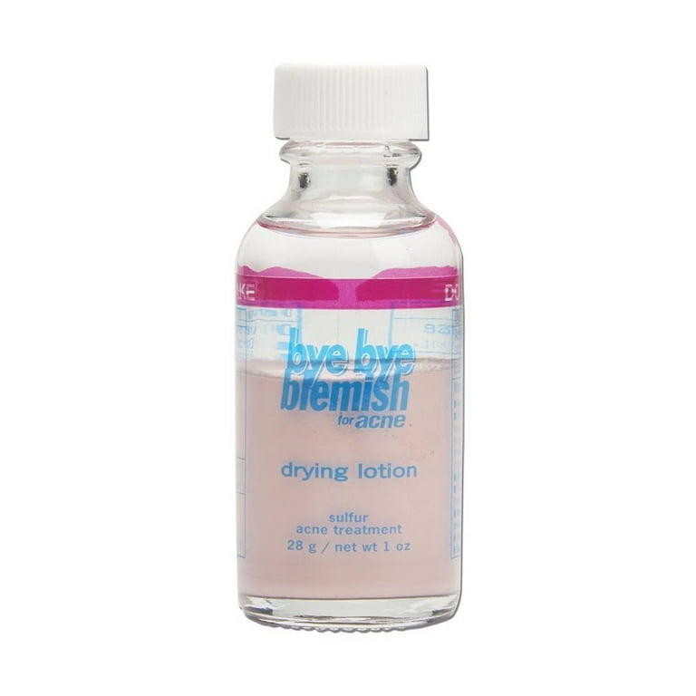 Bye Bye Blemish Drying Lotion For Acne, 1 Oz - Walmart.com